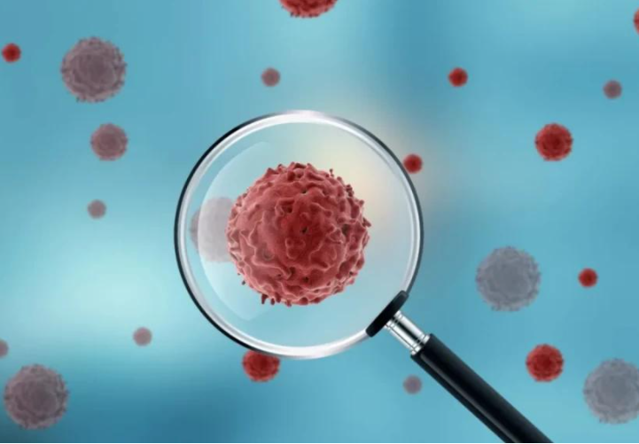 Dry chemistry analyzer VS. wet chemistry analyzer Seamaty