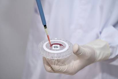 Adding blood samples to the reagent tray.jpg