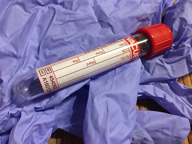 blood specimen