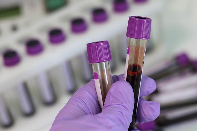Blood Biochemistry Tests
