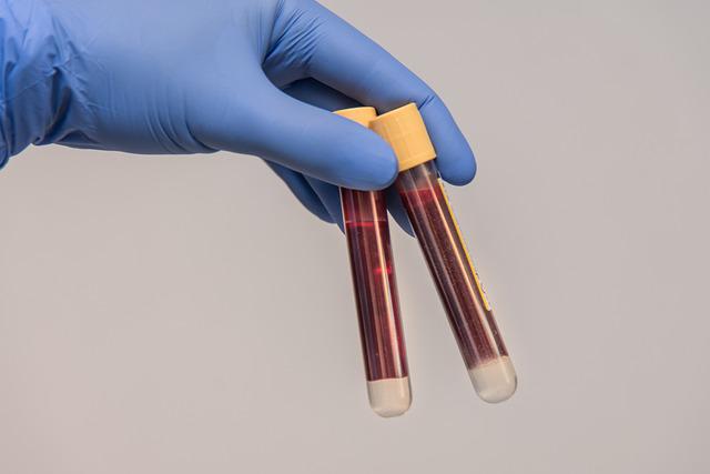 The Difference Between Blood Biochemistry and Routine Blood Tests