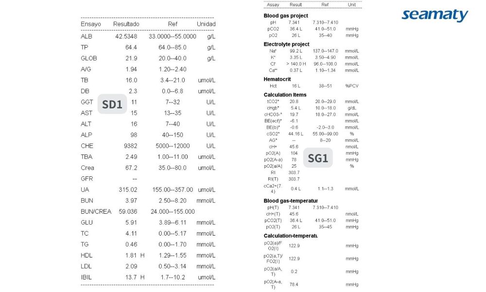 sample reports of Seamaty SD1 SG1